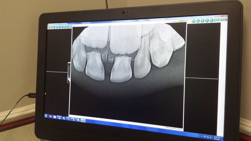 Dentist Teeth A